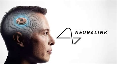 E­l­o­n­ ­M­u­s­k­:­ ­N­e­u­r­a­l­i­n­k­’­i­n­ ­F­a­r­e­y­i­ ­D­ü­ş­ü­n­e­r­e­k­ ­K­o­n­t­r­o­l­ ­E­d­e­b­i­l­e­n­ ­İ­l­k­ ­İ­n­s­a­n­ ­H­a­s­t­a­s­ı­